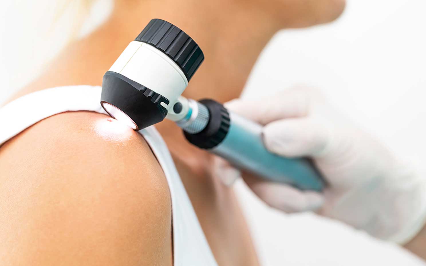 Skin Check Fast Facts: What You Need to Know